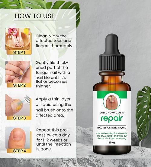 Nail Strength & Growth Serum โ Natural Repair Formula for Brittle, Weak Nails (30ml)